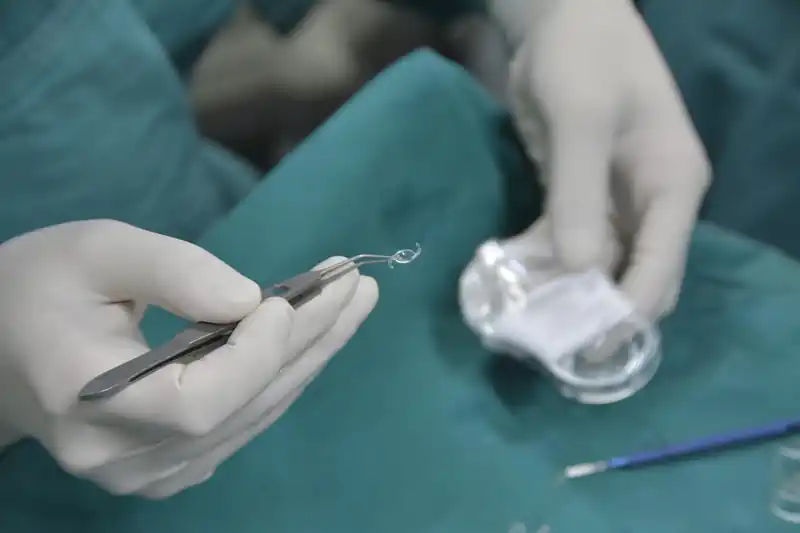 인공수정체 렌즈 종류와 가격