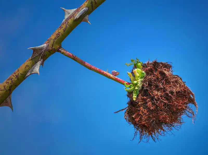 담석증, 왜 생길까?